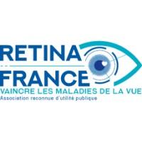 Retina France